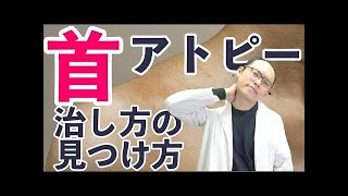 アトピーで首がかゆい原因と対処