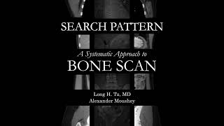 [NM] Bone Scan | Search Pattern