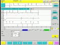 interrogating a microport pacemaker tests egm