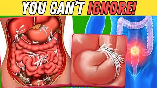 How Intestinal Blockages Threaten Your Health – Know the Risks