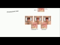 anal fistulas lecture for usmle step 2