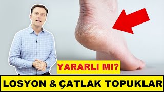 Losyon Neden Çatlamış Topukları ve Kuru Ayakları Asla Düzeltmez? | Dr.Berg Türkçe