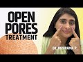 Open Pores | Open Pores Treatment| Open Pores Video| Open Pores Cream  (2024)