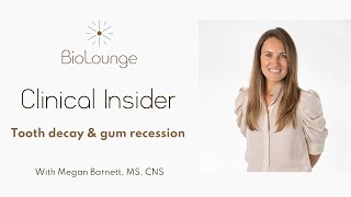 Clinical Insider - Tooth Decay