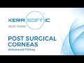 Post Surgical Corneas - Advanced Fitting