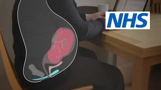 How and when should I do pelvic floor exercises? | NHS