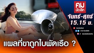 แผลที่ขาแตงโมถูกใบพัดเรือ?