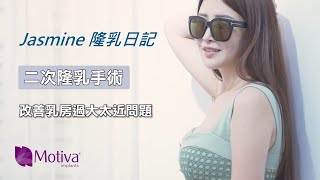 隆乳失敗重修二次隆乳手術 | Motiva魔滴隆乳改善過大乳房太近問題