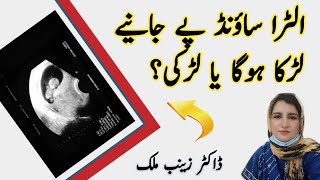 How baby Gender diagnose with ultrasound ? janiye Larka hoga ya Larki ?.@doctorzainabmalik