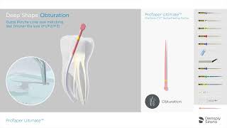 ProTaper Ultimate Endo File System - Obturation Sequence