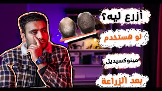 هل يستخدم المينوكسيديل مدى الحياة؟ برنامج البسيط