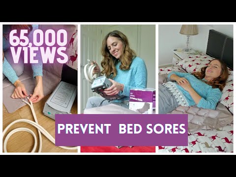 What is anti decubitus mattress?