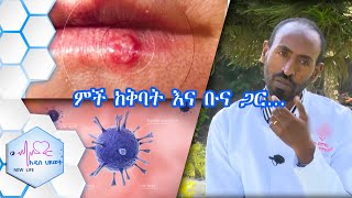 ምች ከቅባት እና ከቡና ጋር ምን ግንኙነት አለው? እና የቆዳ ካንሰር/NEW LIFE