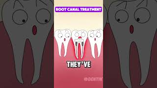 Root Canal Treatment Explained with Animation: Easy \u0026 Clear!