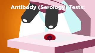COVID-19 Testing 101.