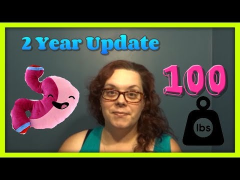 Gastric Sleeve 2 Year Update Gastric Sleeve 2 Year Update