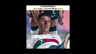 Cristiano Ronaldo bloodied Portugal Match #shorts l Ronaldo Injured Portugal vs Czech Republic #cr7
