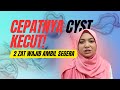 Cara Kecutkan Cyst Cepat