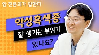 Q. 악성흑색종, 잘 생기는 부위가 있나요? [피부암]