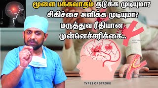 மூளை பக்கவாதம் - உடனே கண்டுபிடிப்பது எப்படி? மருத்துவர் ரீதியான ஒரு முன்னெச்சரிக்கை.. Dr M Prabhu