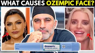 Debunking "Ozempic Face" Myths: Facial Plastic Surgeon Weights in  (is it actually a "thing?")