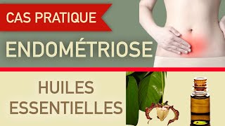 endométriose et huiles essentielles