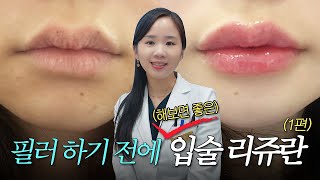 입술 리쥬란으로 겨울철 입술 건강 관리해 보세요! | 입술 필러 고민 중이신 분들도 시청 필수!👀