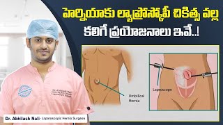 హెర్నియాకు ల్యాప్రోస్కోపీ || Procedure & Benefits of Laparoscopic Hernia Surgery || Dr Abhilash Nali