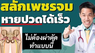 สลักเพชรจม ปวดสลักเพชร  หายปวดได้ เร็ว ไม่ต้องผ่าตัด ให้ทำแบบนี้ | หมอซัน หมอฝังเข็ม