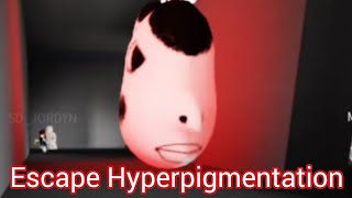 Escape Hyperpigmentation - Full Walkthrough | Roblox