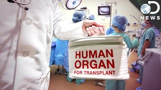 Why Do Organ Transplants Fail So Often?