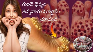 చాలా భయంకరమైన disease // top most interesting facts Telugu