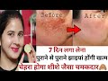 100% effective 7 days challenge pigmentation Remove naturally | glowing skin best remedy