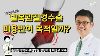 [최초 공개] 발목관절경수술, 미용만이 목적일까? (순천향대학교 부천병원 정형외과 이영구 교수)