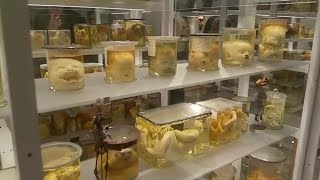 Non solo formalina: i reperti del museo di anatomia di Padova