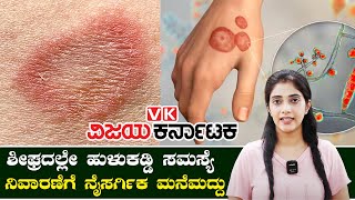 Ringworm : ಮಳೆಗಾಲದಲ್ಲಿ ಕಾಡುವ ಹುಳುಕಡ್ಡಿ ಸಮಸ್ಯೆಗೆ ಸಿಂಪಲ್ ಮನೆಮದ್ದು | Vijay Karnataka