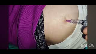 Doctor check girl injection videos #shortvideo #trending #viralpage #reels #youtubeshorts #shorts