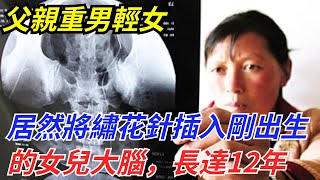 父親重男輕女，居然將繡花針插入剛出生的女兒大腦，長達12年【趣聞奇事說】#奇聞#故事#奇聞觀察室#好奇零零漆#見世君#案件解讀