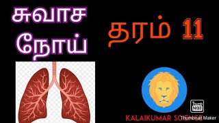 சுவாச நோய்கள்