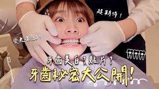 最常被問！粿粿牙齒療程大公開！牙齒矯正/隱適美/美白貼片 日常VLOG :: 粿粿の日常 :