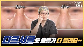 다크서클마다 없애는 방법도 가.지.각.색?! - 닥터 전효진