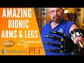 Amazing Robot Arms & Legs - Futuristic Robotic Prosthetics