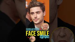 Remove Face SMILE LINES Exercises