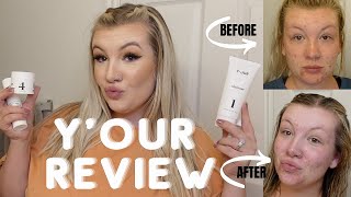 Y'OUR SKINCARE REVIEW WITH BEFORE AND AFTERS! I'M SHOOK!!