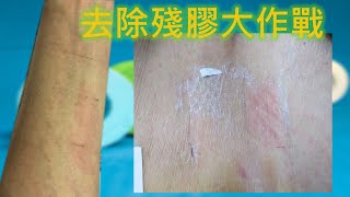 如何去除傷口膠帶的殘膠 How to remove sticky residue from wound tapes