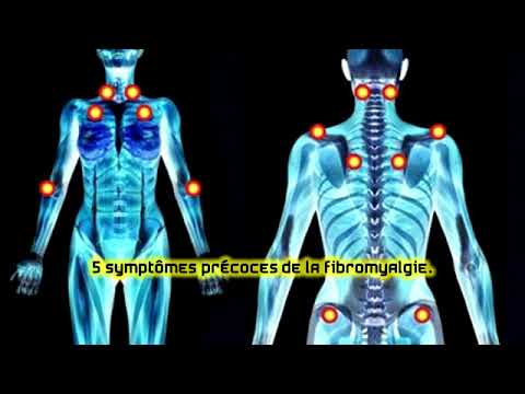 5 Symptômes Précoces De La Fibromyalgie - YouTube