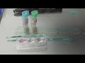 embryo freezing – vitrification step by step how are embryo’s frozen and stored in the ivf lab