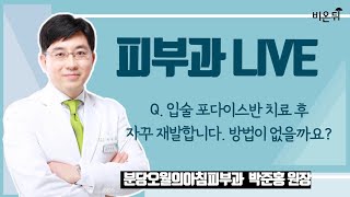 [피부과 라이브] Q. 입술 포다이스반 치료 후 자꾸 재발합니다. 방법이 없을까요? (분당오월의아침피부과 박준홍 원장)