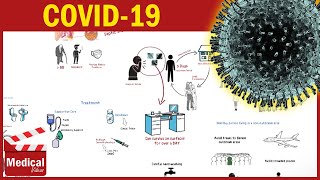 COVID-19 ( Coronavirus Disease 19) - causes, symptoms, diagnosis, treatment, precautions