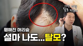 탈모자가진단? 따라해보세요. 1분안에 진단하는 방법 - 17년차 전문의 김진오 원장